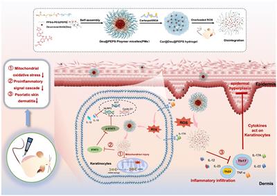 Reactive oxygen species-responsive supramolecular deucravacitinib self-assembly polymer micelles alleviate psoriatic skin inflammation by reducing mitochondrial oxidative stress